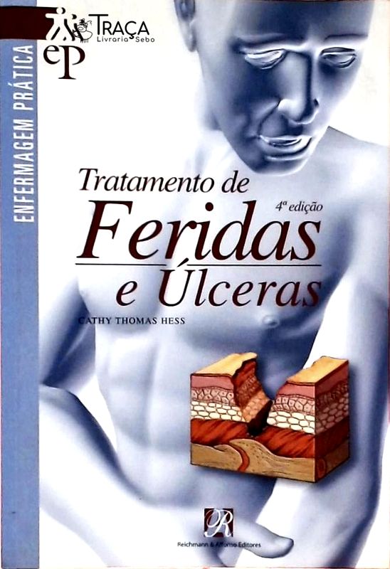 Tratamento de Feridas e Úlceras