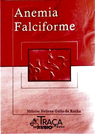 Anemia Falciforme