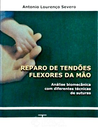 Reparo de Tendões Flexores da Mão