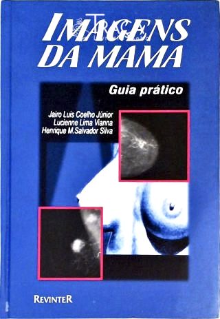 Imagens da Mama