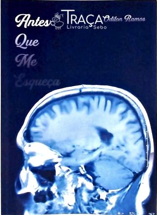 Antes Que Me Esqueça (autografado)