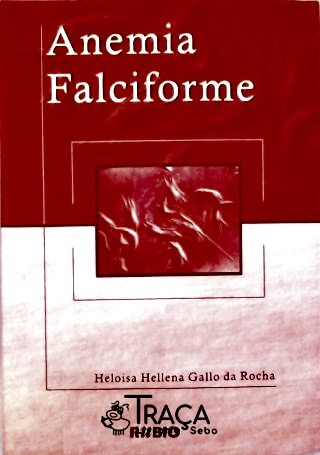 Anemia Falciforme