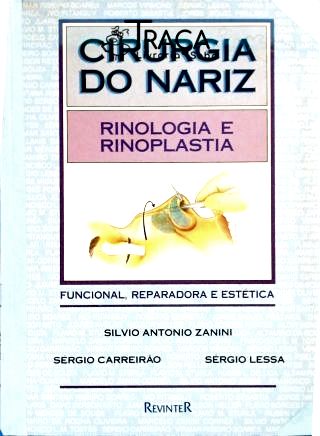 Cirurgia do Nariz