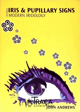 Iris And Pupillary Signs