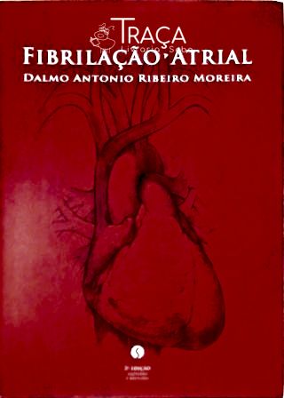 Fibrilação Atrial