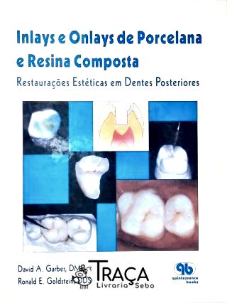 Inlays e Onlays de Porcelana e Resina Composta