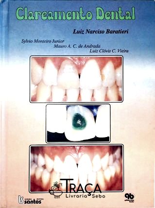 Clareamento Dental