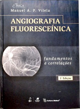 Angiografia Fluoresceínica