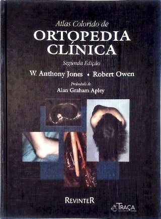 Atlas Colorido de Ortopedia Clinica