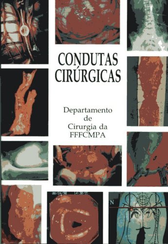 Condutas Cirúrgicas