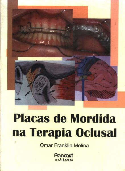 Placas De Mordida Na Terapia Oclusal