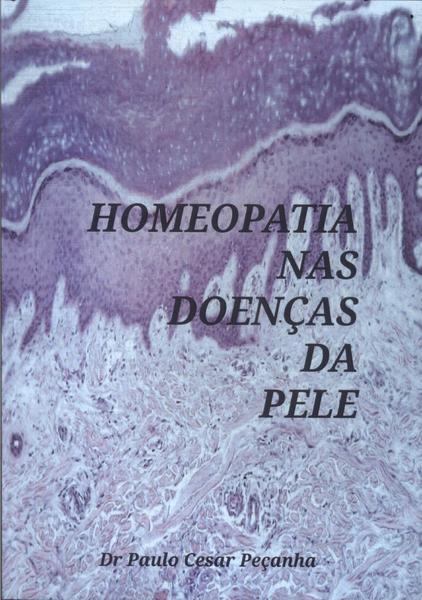 Homeopatia Nas Doenças Da Pele