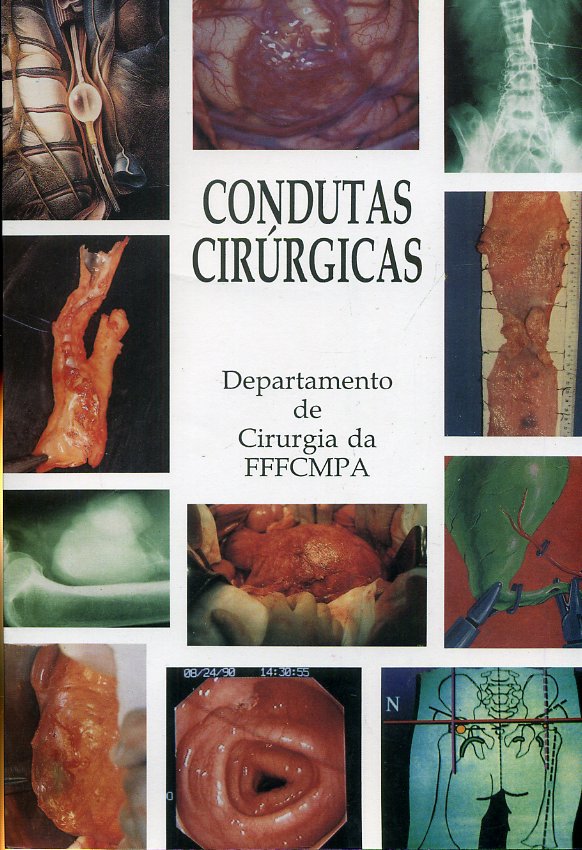 Condutas Cirúrgicas