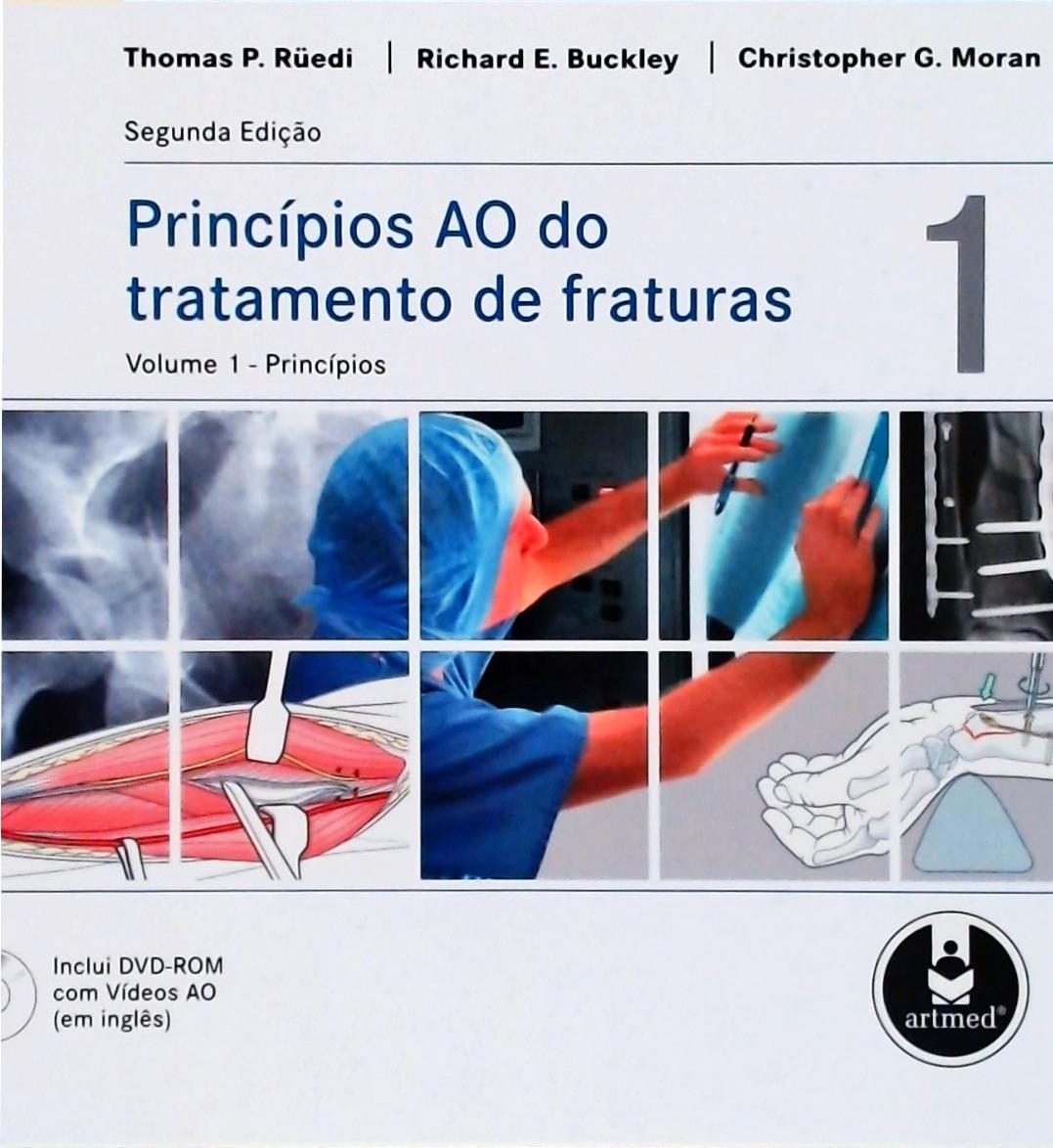 Princípios AO do Tratamento de Fraturas (2 volumes)