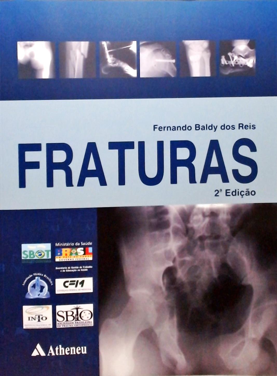 Fraturas