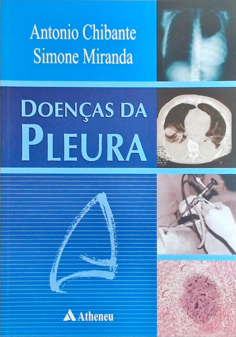 Doenças da pleura