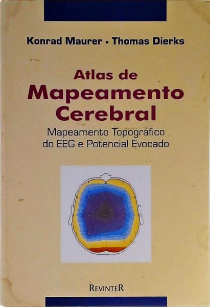 Atlas De Mapeamento Cerebral