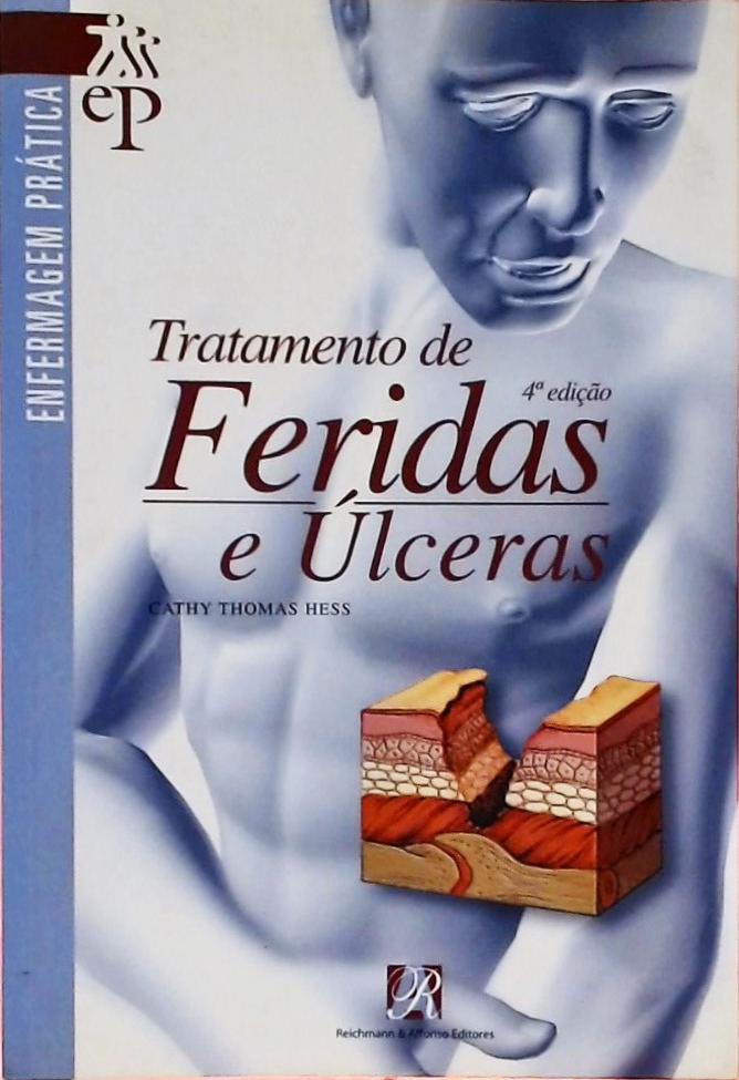 Tratamento De Feridas E Úlceras