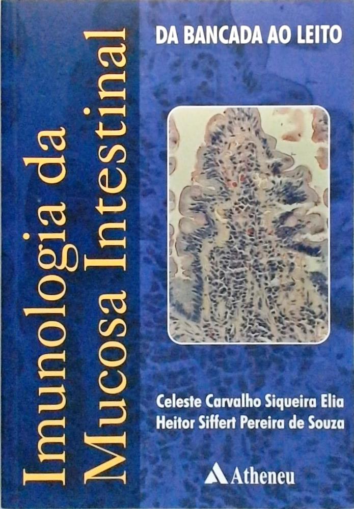 Imunologia da mucosa intestinal