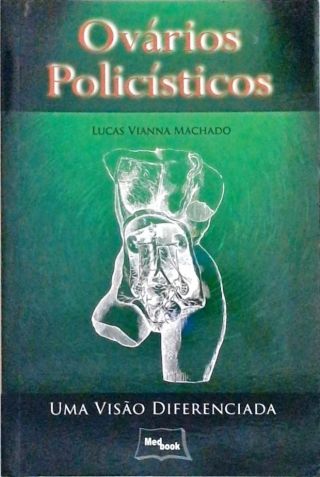 Ovários Policísticos