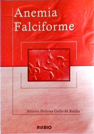 Anemia Falciforme