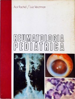 Reumatologia Pediátrica