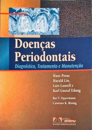 Doenças Periodontais