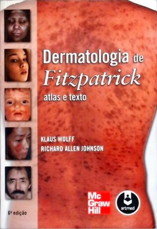 Dermatologia de Fitzpatrick
