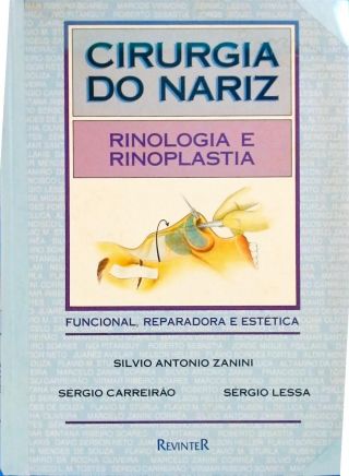 Cirurgia do nariz