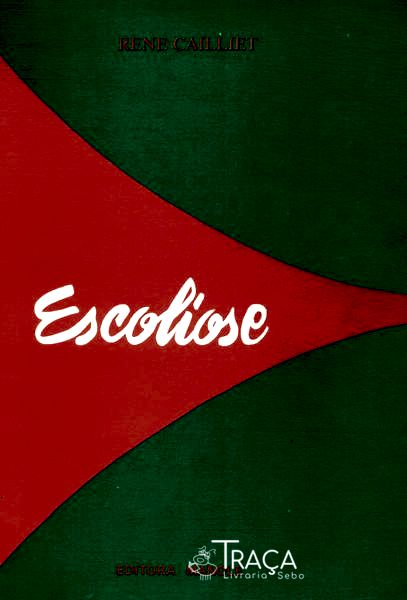 Escoliose: Diagnóstico e Tratamento
