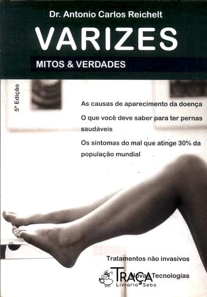 Mitos e Verdades: Varizes
