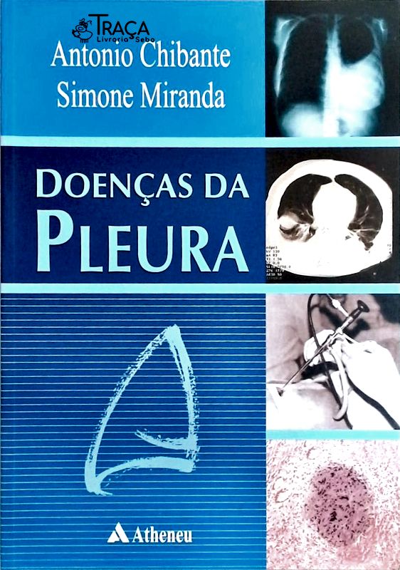 Doenças da Pleura