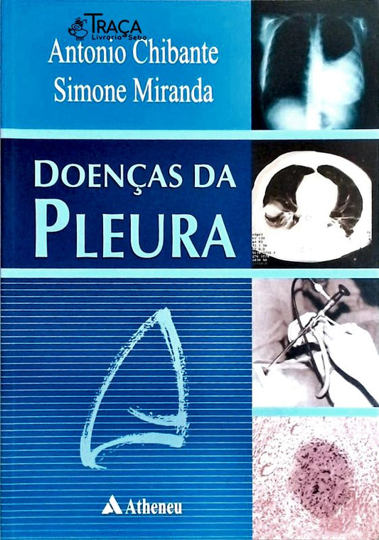 Doenças da Pleura