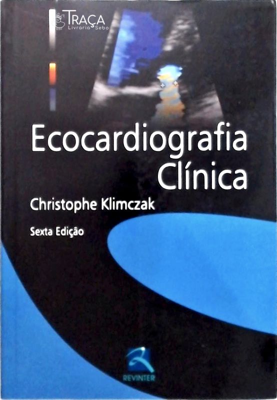 Ecocardiografia Clínica