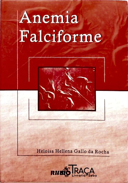 Anemia Faciforme