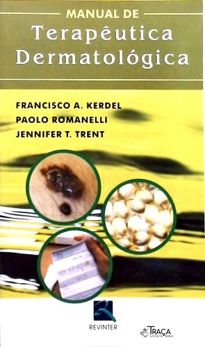 Manual de Terapêutica Dermatologica
