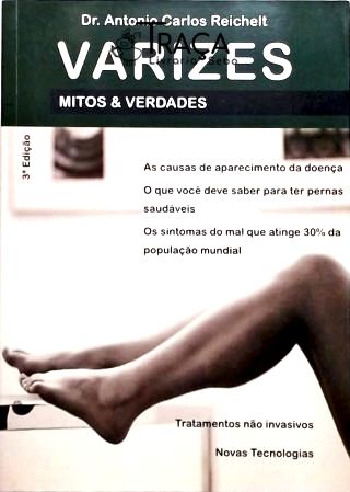Varizes: Mitos e Verdades