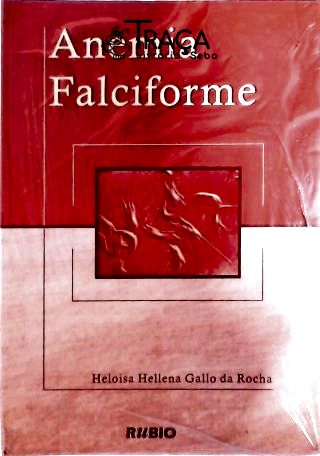 Anemia Falciforme
