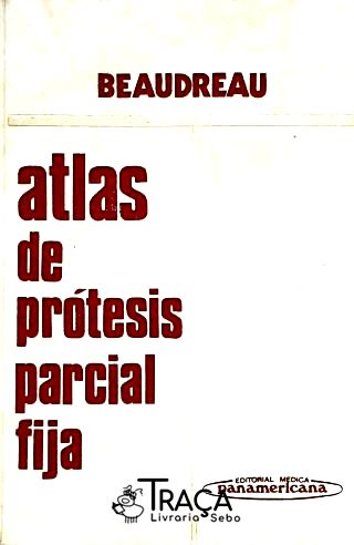 Atlas de Protesis Parcial Fija