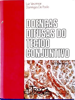 Doenças Difusas do Tecido Conjuntivo