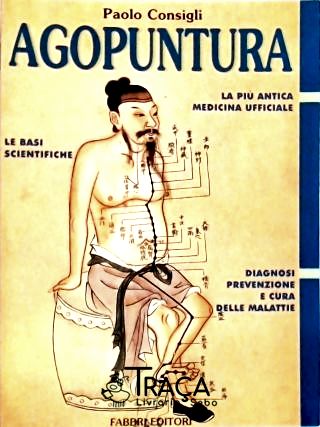 Agopuntura