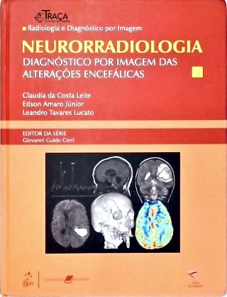 Neurorradiologia - Diagnóstico por Imagem das Alterações Encefálicas