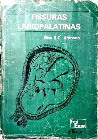 Fissuras Labiopalatinas