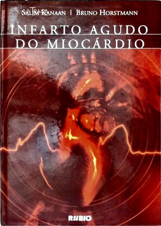 Infarto Agudo do Miocárdio