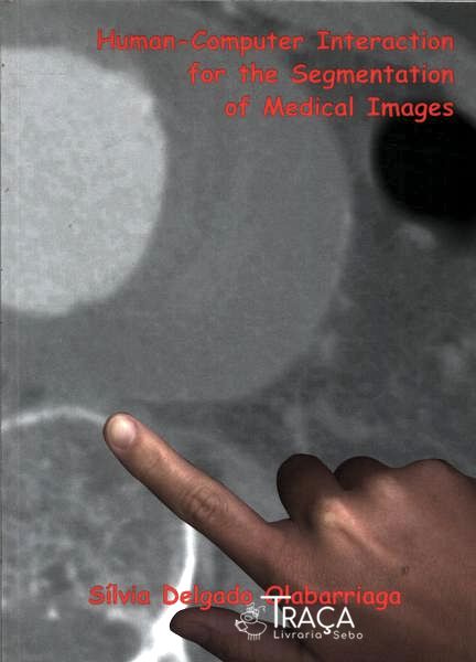 Human-computer Interaction For The Segmentation Of Medical Images