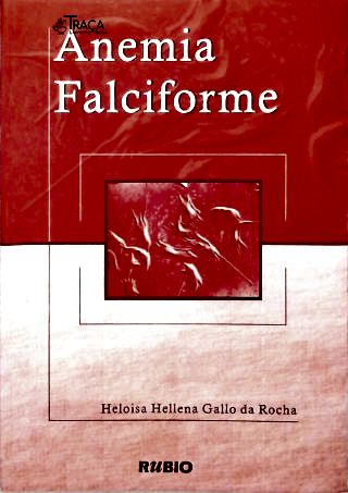 Anemia Falciforme