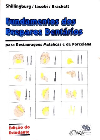 Fundamentos dos Preparos Dentários para Restaurações Metálicas e de Porcelana