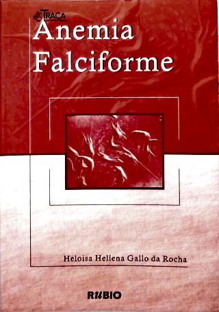 Anemia Falciforme
