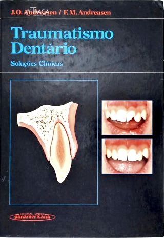 Traumatismo Dentário: Soluções Clínicas