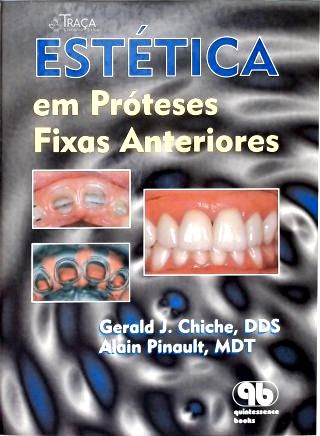 Estéticas em Próteses Fixas Anteriores